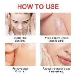 how to use pimple acne patch