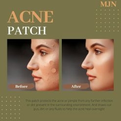 pimple remover acne patch for men & women